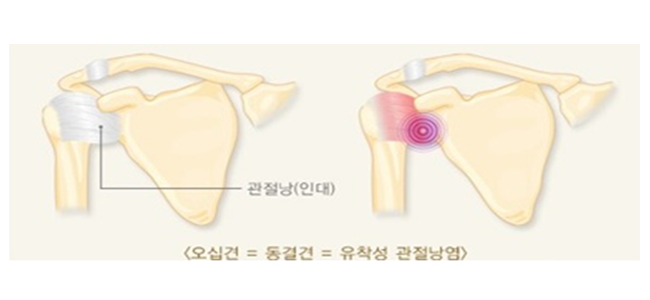 이미지명