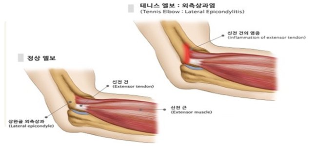 이미지명