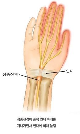이미지명