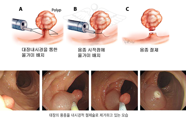 이미지명