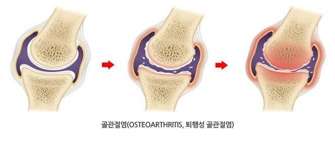 이미지명