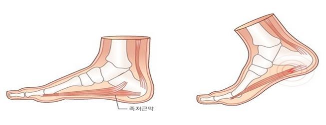 이미지명