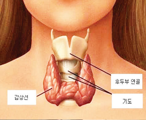 이미지명